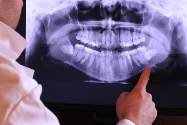 Best Emergency Tooth Extraction in Alamo, TX