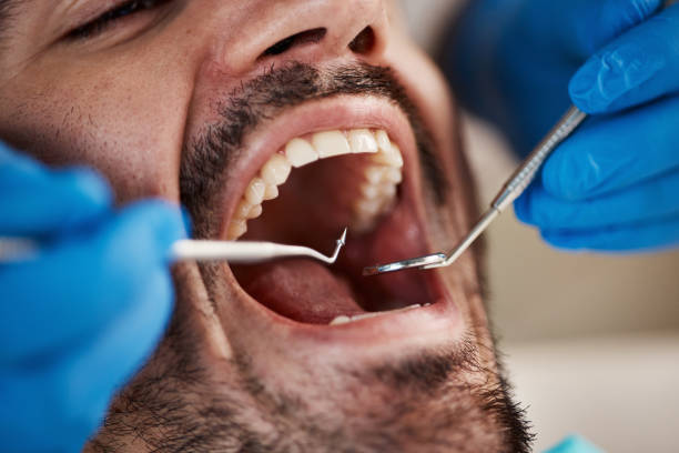 Best Emergency Dental Care for Broken or Chipped Teeth in Alamo, TX